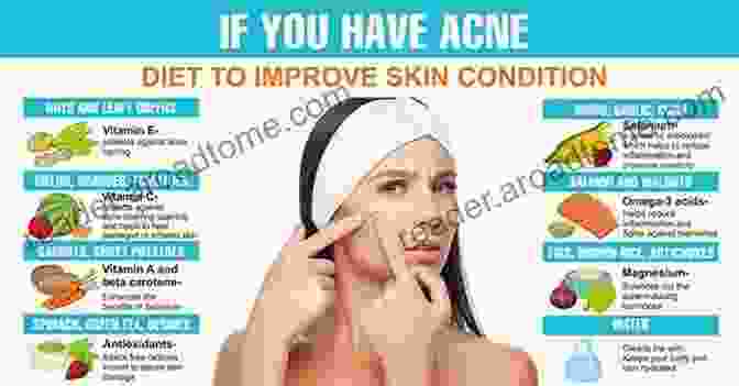 A Healthy Diet Supports Skin Health And Can Help Combat Acne. Acne Solution: Get Rid Of Acne With Simple Natural Remedies