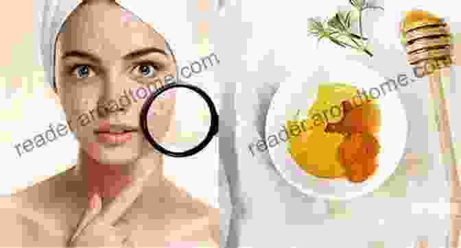 Honey, A Versatile Natural Remedy For Acne. Acne Solution: Get Rid Of Acne With Simple Natural Remedies