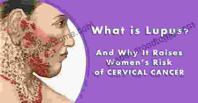 Understanding The Chances Of Getting Cancer With Lupus Chances Of Getting Cancer With Lupus: 16 Cancer Types Linked To SLE