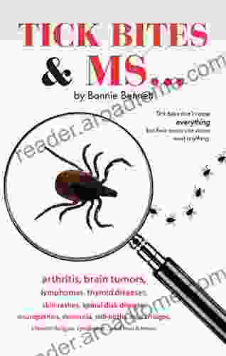 Tick Bites MS